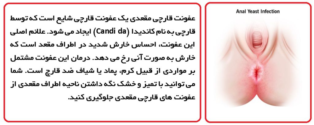 علائم سرطان بواسیر+علائم تومور مقعدی